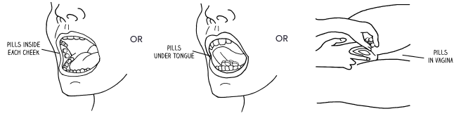 Take misoprostol